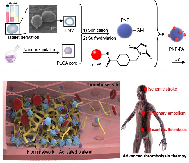 Recent advances in the study of thrombus-regulating nanomedicine by Prof. Guangjun Nie’s Group